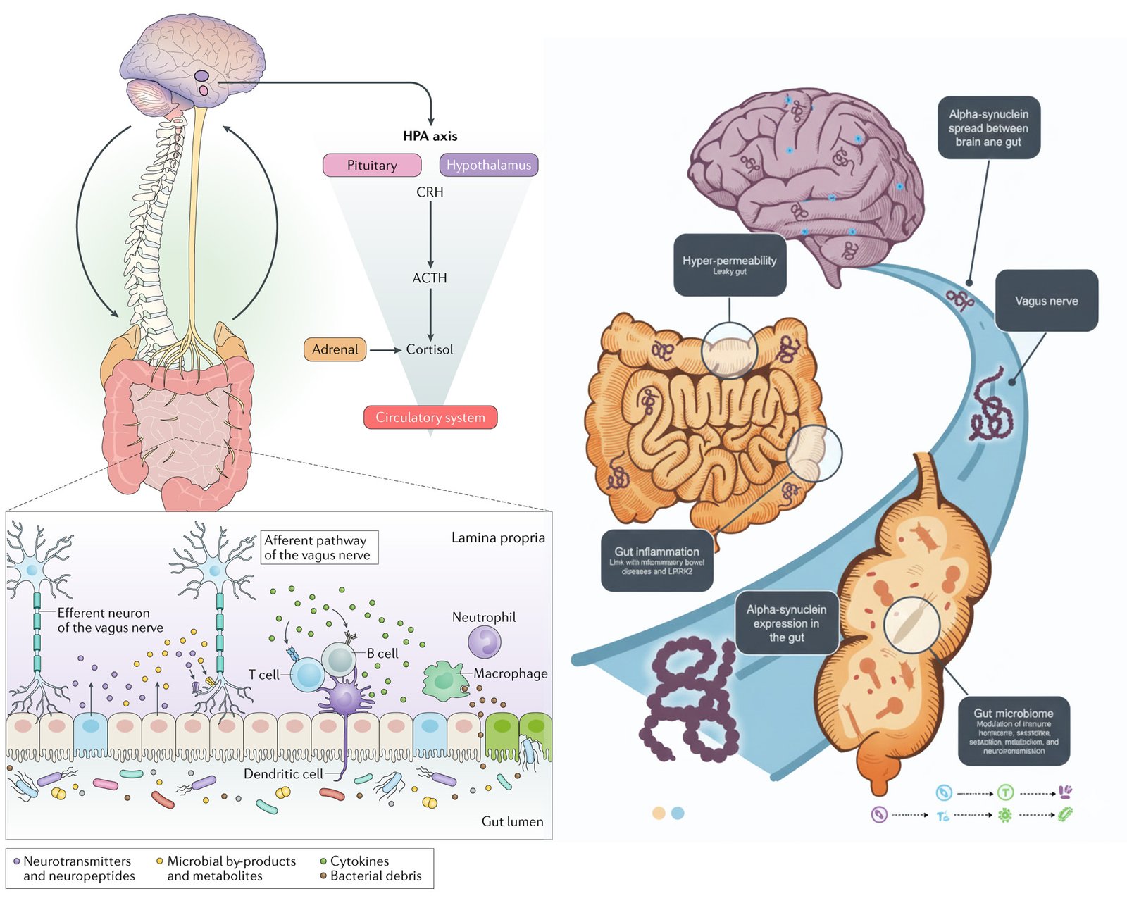 FMT Treatment for Neurologic Disorders - Autism, Alzheimer's, Parkinson's, Multiple Sclerosis, Depression, Anxiety